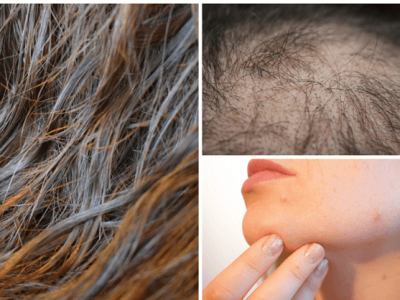 Health First | ओल्या केसांमध्ये झोपल्याने पडू शकते ‘टक्कल’ – नक्की वाचा