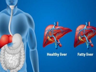 Fatty Liver Disease Signs | मद्यपान न करणाऱ्यांनाही फॅटी लिव्हरची समस्या होऊ शकते | ही लक्षणे वाचा