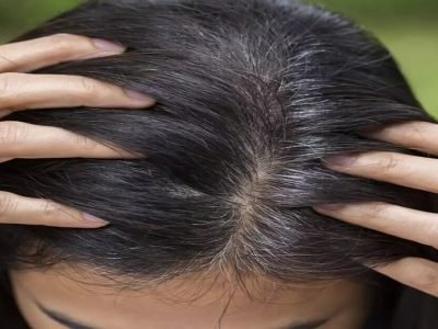 Grey Hair Solutions | पांढऱ्या-ग्रे केसांमुळे त्रस्त आहात तर घरीच करा ‘हे’ 5 उपाय, फॉलो करा टिप्स