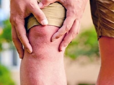 Health First | संधिवाताच्या समस्येवर करा हे योग्य उपचार । नक्की वाचा Health First | संधिवाताच्या समस्येवर करा हे योग्य उपचार । नक्की वाचा