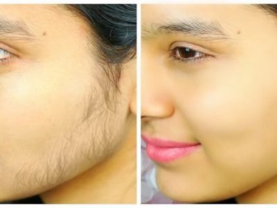 Health First | चेहऱ्यावरील अनावश्यक केस काढण्यासाठी ‘हे’ घरगुती उपाय | नक्की ट्राय करा Health First | चेहऱ्यावरील अनावश्यक केस काढण्यासाठी ‘हे’ घरगुती उपाय | नक्की ट्राय करा