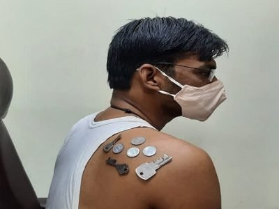 खरंच की चिकटा-चिकाटीचा ट्रेंड? | नाशिकनंतर परभणीतही लस घेतलेल्या व्यक्तीच्या अंगाला चिकटले नाणे