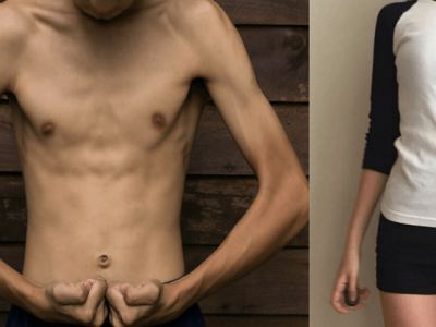 Health First | खूप बारीक आहात? | या टिप्सनी वाढेल तुमचे वजन