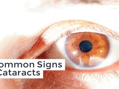 Cataract Symptoms and Treatment | ‘मोतीबिंदू’ आजार वेळीच गांभीर्याने घ्या | लक्षण व उपचार – नक्की वाचा