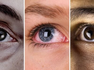Health First | डोळे निरोगी आणि सुंदर ठेवण्यासाठी आहेत या सोप्प्या टिप्स