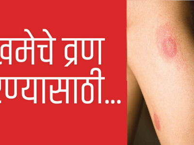 Health First | शरीरावरील जखमांचे व्रण कमी करणारे हे घरगुती उपाय माहित आहेत? – नक्की वाचा