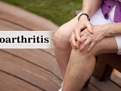 Health First | संधिवात आजार आणि  उपचार – नक्की वाचा