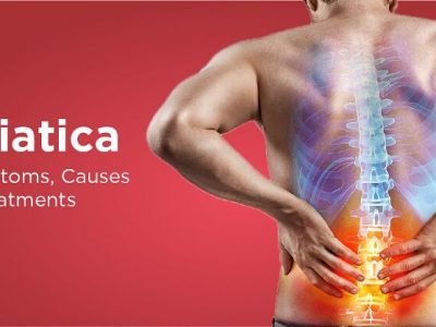 Sciatica Symptoms | ‘सायटिका’ हा गंभीर आजार काय आहे? याची लक्षणे व उपचार – नक्की वाचा