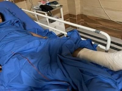 नंदीग्राम हल्ला | ममता बॅनर्जींच्या पायाला प्लॅस्टर | TMC निवडणूक आयोगाकडे तक्रार करणार